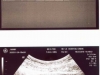 usg_10weeks-59