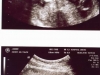 usg_13weeks-60