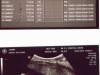 usg_22weeks-62
